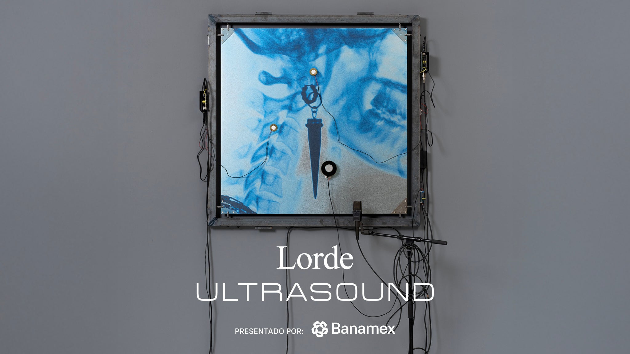 Lorde - Ultrasound