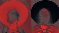 Unkle